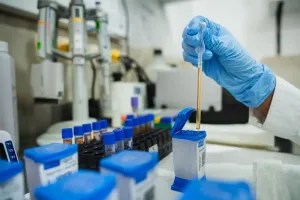 A sample is placed in a GeneXpert cartridge at a PIH-supported facility in Peru.