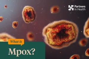 What is mpox graphic? 