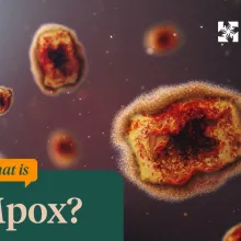 What is mpox graphic? 